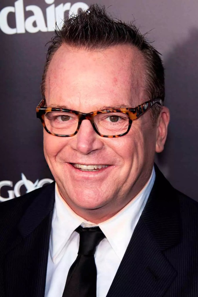 Tom Arnold’s Short Faux Hawk haircuts for balding men #haircutsforbaldingmen #baldmenhaircuts